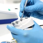 Jakie są najczęstsze przyczyny utraty zębów i jak Protetyk Bemowo może pomóc? Jakie są najczęstsze przyczyny utraty zębów i jak Protetyk Bemowo może pomóc?